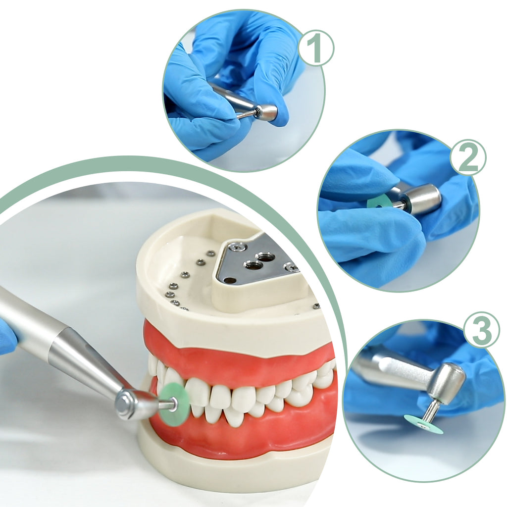LYuen Autoclavable Polishing Discs-Dental Polishing Discs +Mandrel,Autoclavable Polishing Discs,Dental Consumables for Lab & Clinic(Mixed Grits)
