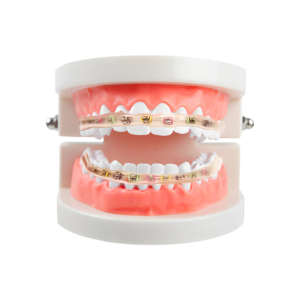 LYuen 1 Set Orthodontic Cheek Tube Protective Cover – Comfortable Lip Guard/Tooth Guard, Soft Plastic Braces Shield for Metal Components & Wires, Orthodontic Accessory