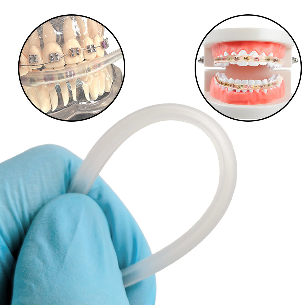 LYuen 1 Set Orthodontic Cheek Tube Protective Cover – Comfortable Lip Guard/Tooth Guard, Soft Plastic Braces Shield for Metal Components & Wires, Orthodontic Accessory