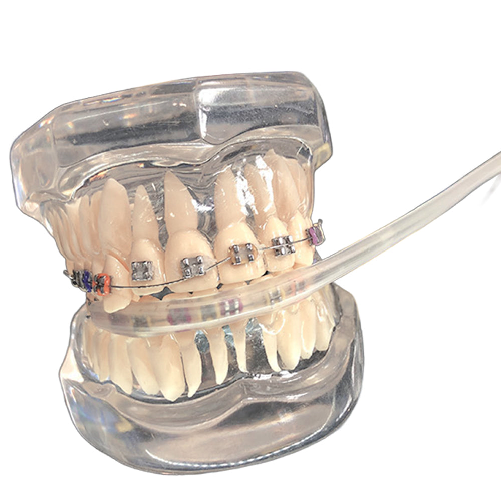 LYuen 1 Set Orthodontic Cheek Tube Protective Cover – Comfortable Lip Guard/Tooth Guard, Soft Plastic Braces Shield for Metal Components & Wires, Orthodontic Accessory