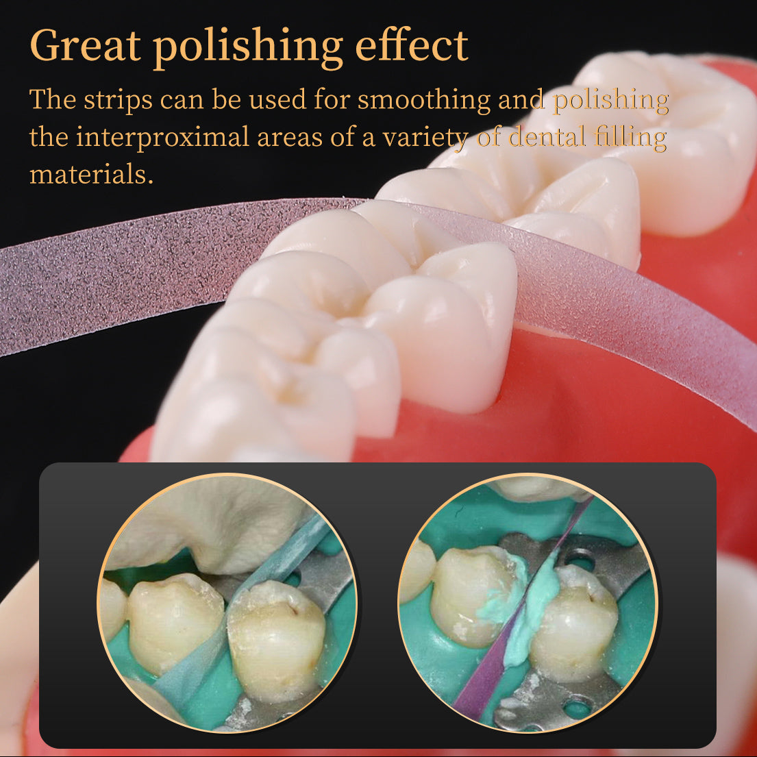 LYuen 1 Roll Dental Polishing Strip – Resin Teeth Grinding & Sanding Shaping Tool, Flexible Dentist Material for Interproximal Finishing