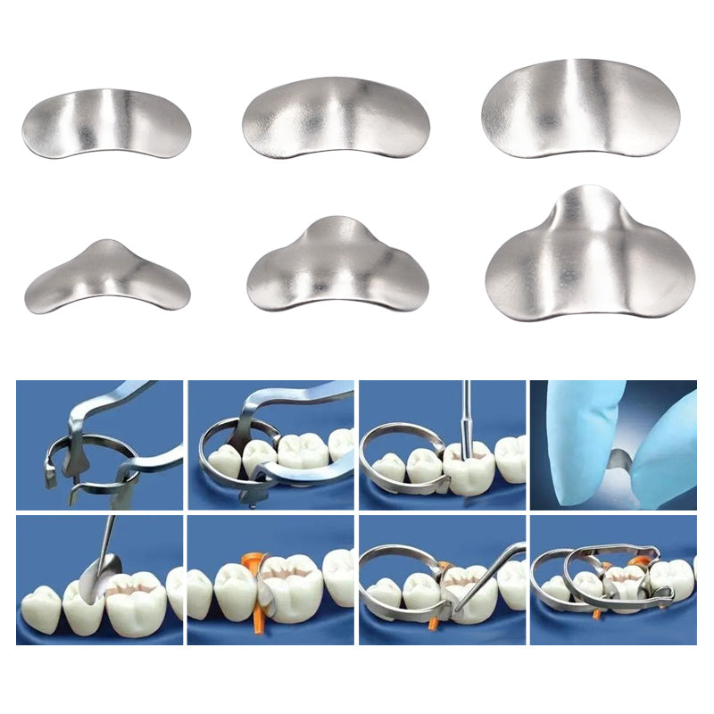LYuen 100Pcs/Box Sectional Matrix System – Metal Matrices Clamping/Separating Rings with Springclip Plier, Stainless Steel Dental Tools for Restorative Procedures
