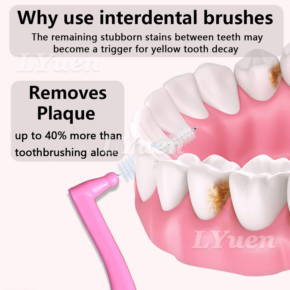 LYuen 20Pcs L-Shaped Short Interdental Brush – Ultrathin Mini Brush for Orthodontic Braces Cleaning & Between Teeth