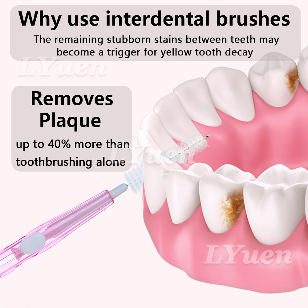 LYuen 60pcs Interdental Brushes Set – Push-Pull Orthodontic Toothbrush for Braces Cleaning, Soft Bristles Travel Portable