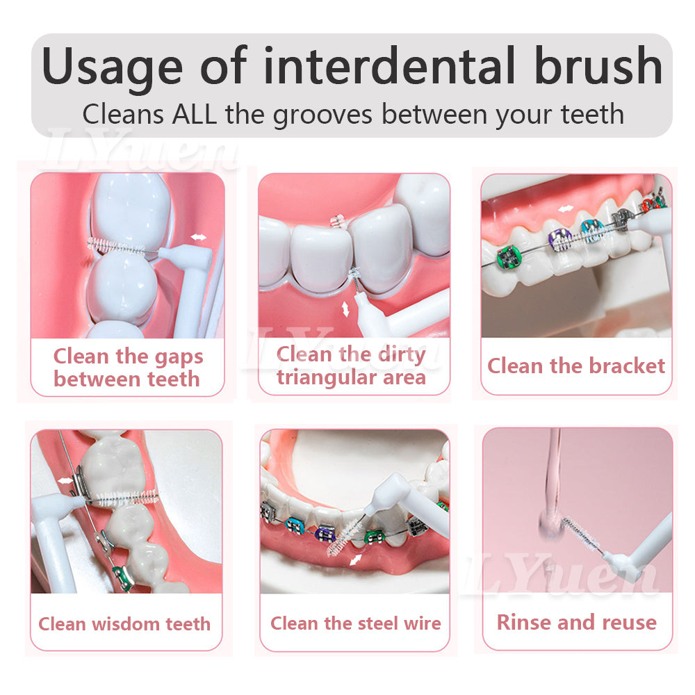 LYuen 60pcs Interdental Brushes Set – Push-Pull Orthodontic Toothbrush for Braces Cleaning, Soft Bristles Travel Portable