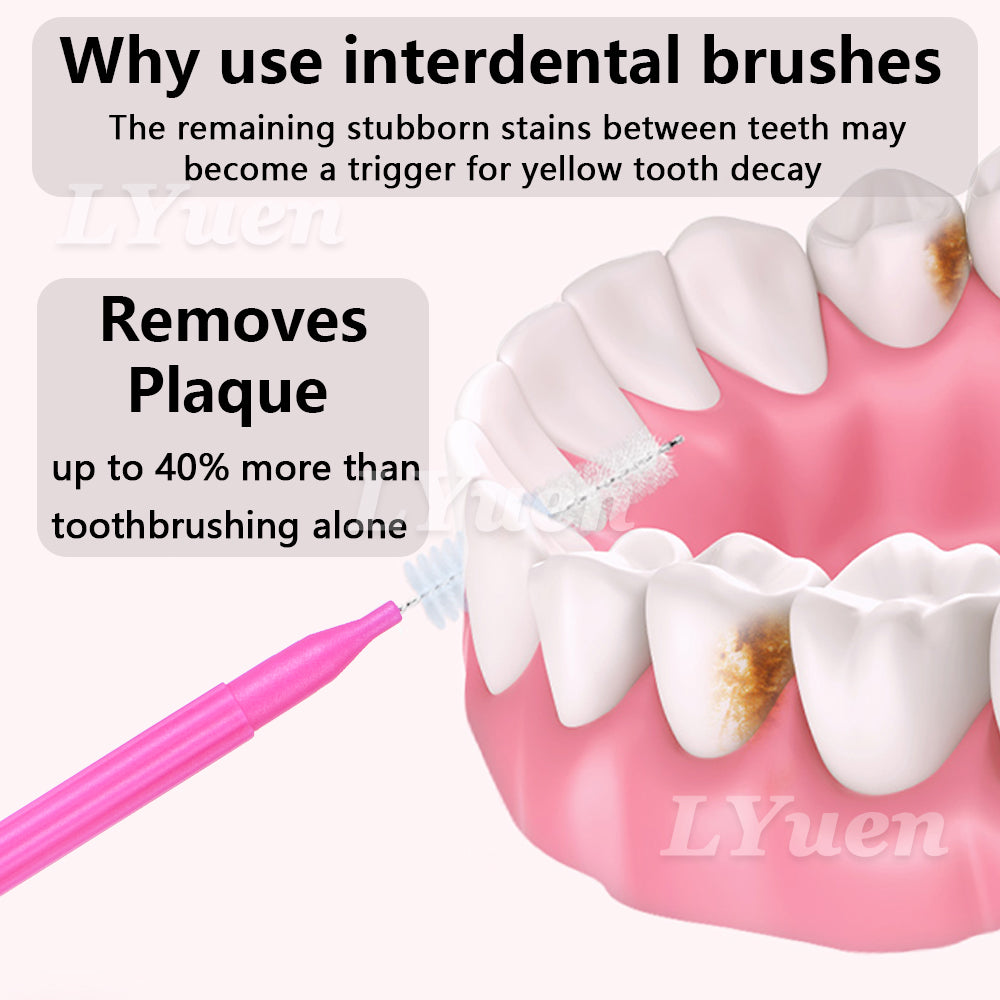 LYuen 5 Sizes Orthodontic Interdental Brushes – 60Pcs Extra Slim Dental Picks for Tight Gaps & Bridge Care, Thin Handle Design